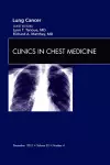 Lung Cancer, An Issue of Clinics in Chest Medicine cover