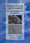 Bone Loss and Osteoporosis cover