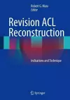 Revision ACL Reconstruction cover