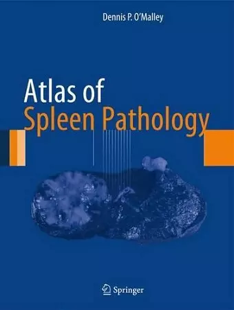 Atlas of Spleen Pathology cover