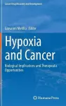 Hypoxia and Cancer cover