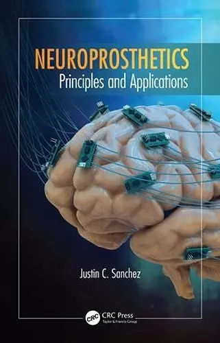 Neuroprosthetics cover