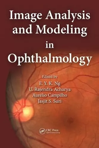 Image Analysis and Modeling in Ophthalmology cover