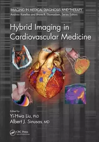 Hybrid Imaging in Cardiovascular Medicine cover