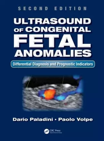 Ultrasound of Congenital Fetal Anomalies cover