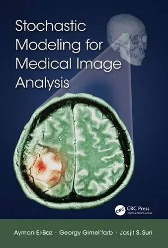 Stochastic Modeling for Medical Image Analysis cover