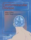 Current Review of Cerebrovascular Disease cover