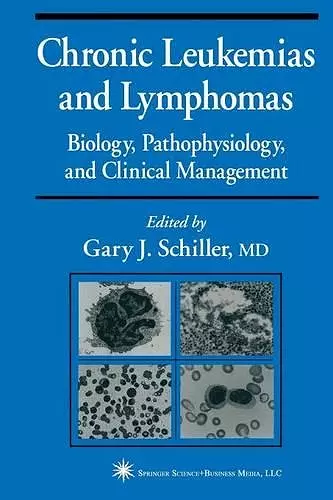 Chronic Leukemias and Lymphomas cover