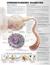 Understanding Diabetes Anatomical Chart cover