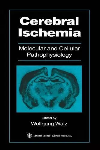 Cerebral Ischemia cover