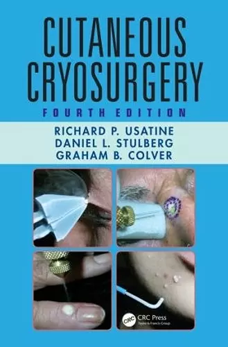 Cutaneous Cryosurgery cover