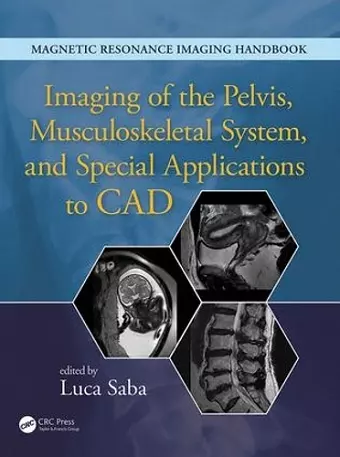 Imaging of the Pelvis, Musculoskeletal System, and Special Applications to CAD cover