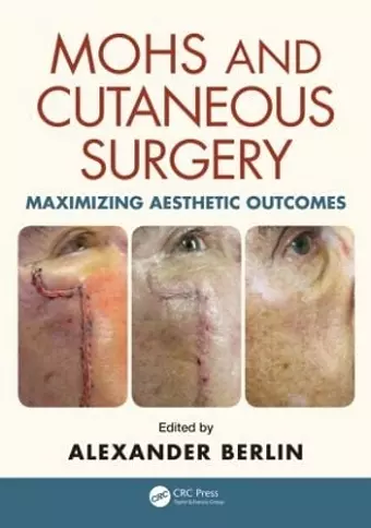 Mohs and Cutaneous Surgery cover