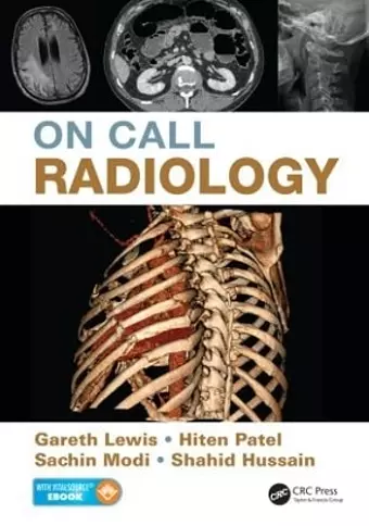 On Call Radiology cover
