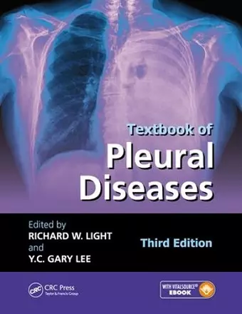 Textbook of Pleural Diseases cover