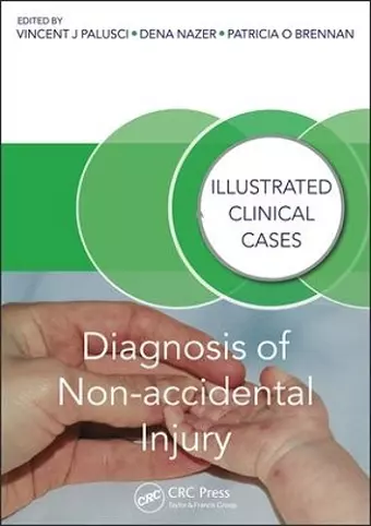 Diagnosis of Non-accidental Injury cover