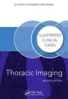 Thoracic Imaging cover