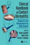 Clinical Handbook of Contact Dermatitis cover