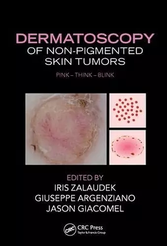 Dermatoscopy of Non-Pigmented Skin Tumors cover