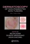 Dermatoscopy of Non-Pigmented Skin Tumors cover