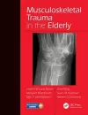 Musculoskeletal Trauma in the Elderly cover