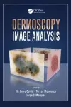 Dermoscopy Image Analysis cover