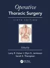 Operative Thoracic Surgery cover