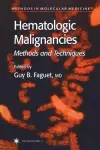 Hematologic Malignancies cover