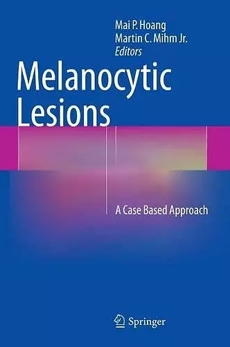 Melanocytic Lesions cover