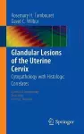 Glandular Lesions of the Uterine Cervix cover