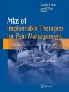 Atlas of Implantable Therapies for Pain Management cover