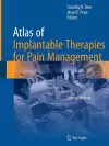 Atlas of Implantable Therapies for Pain Management cover