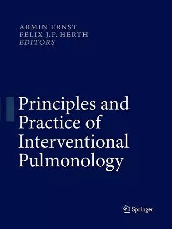 Principles and Practice of Interventional Pulmonology cover