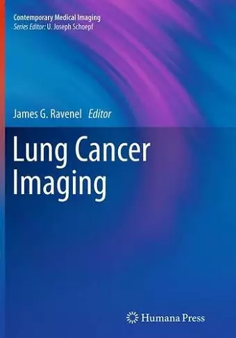 Lung Cancer Imaging cover