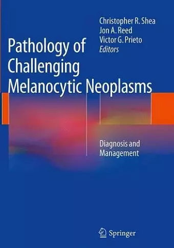 Pathology of Challenging Melanocytic Neoplasms cover