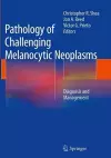 Pathology of Challenging Melanocytic Neoplasms cover