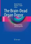 The Brain-Dead Organ Donor cover