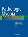 Pathologic Myopia cover