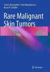 Rare Malignant Skin Tumors cover