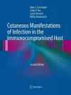 Cutaneous Manifestations of Infection in the Immunocompromised Host cover