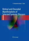 Retinal and Choroidal Manifestations of Selected Systemic Diseases cover