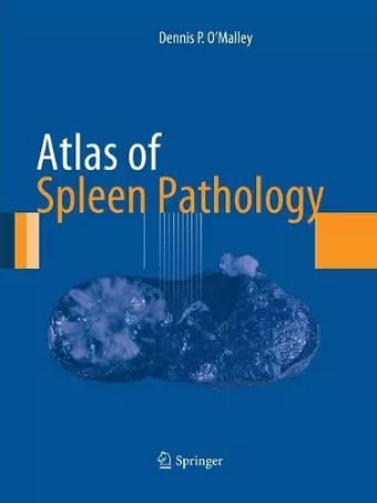 Atlas of Spleen Pathology cover