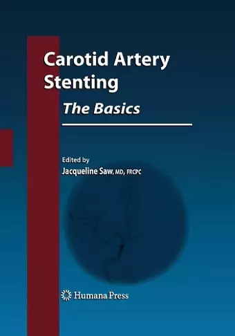 Carotid Artery Stenting: The Basics cover