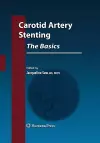 Carotid Artery Stenting: The Basics cover