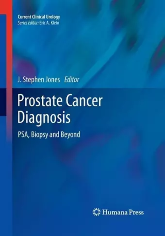 Prostate Cancer Diagnosis cover