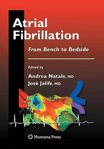 Atrial Fibrillation cover