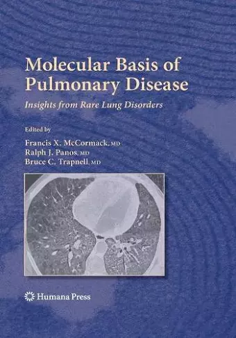 Molecular Basis of Pulmonary Disease cover