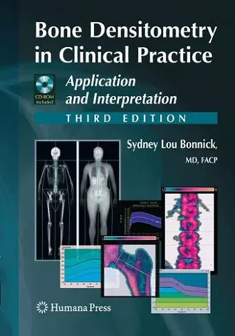 Bone Densitometry in Clinical Practice cover