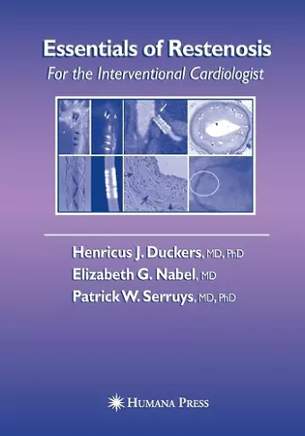 Essentials of Restenosis cover