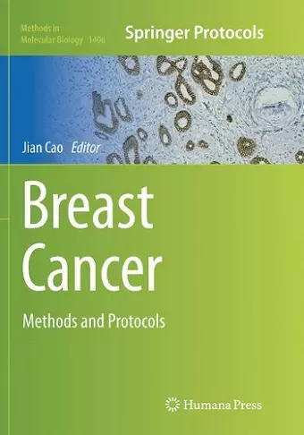 Breast Cancer cover